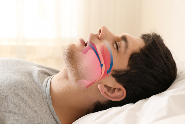 Sleeping With Mouth Open Holotropic Breathwork