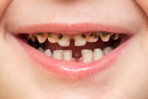 Rotten Tooth SmellCauses | Holotropic Breathwork